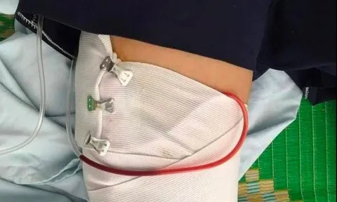 Hỗn chiến, nghi nổ súng tại thành phố Quy Nhơn